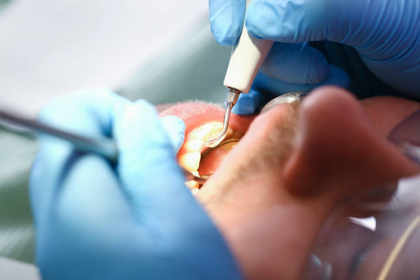Best Emergency Dental Care for Sports Injuries in Dawson Springs, KY